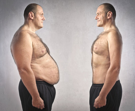 بیست درصد موارد چاقی علت ژنتیکی دارد