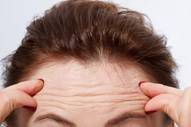 Wrinkles linked to heart disease