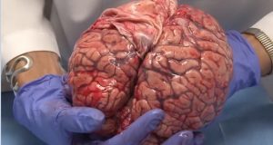 کالبد شکافی مغز انسان را در این ویدیوی شگفت‌انگیز تماشا کنید