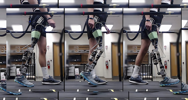 پروتزهای پا به لطف هوش مصنوعی به بیماران کمک ‌می‌کنند که سریع‌تر و بهتر راه بروند