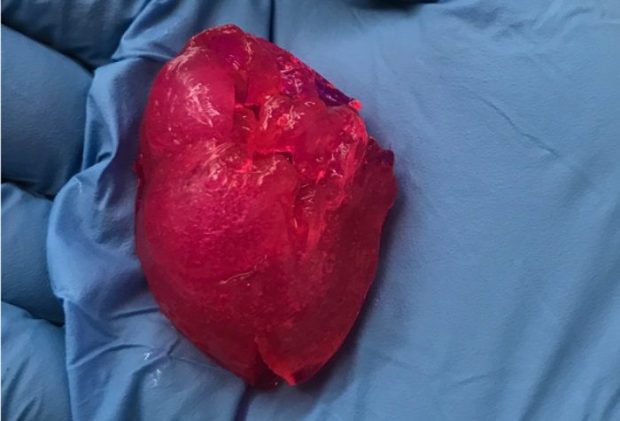 پرینت سه بعدی قلب
