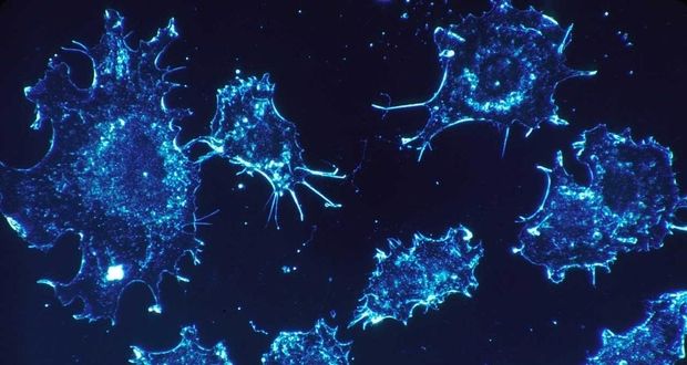 توقف سلول‌های سرطان با تکنیک جدید دانشمندان میشیگان آمریکا