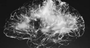 اسکن مغزی بیماران کرونا از تاثیرات عصبی مخرب کووید 19 خبر می‌دهد