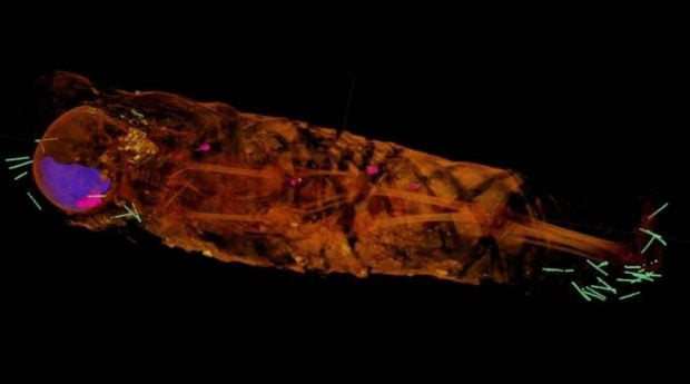 اسکن اشعه ایکس یک مومیایی مصری کشف شوکه کننده‌ای به همراه داشت