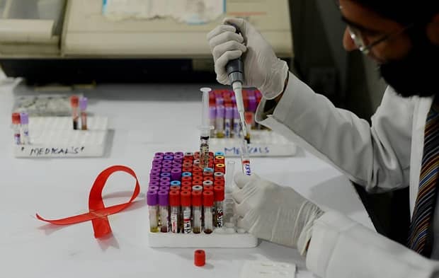 اولین آزمایش انسانی واکسن ایدز