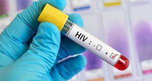 درمان پنجمین مریض مبتلا به اچ آی وی و بیماری ایدز