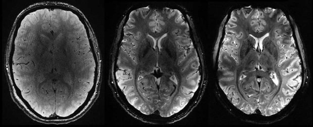 تصاویر مغز انسان در قوی ترین دستگاه MRI
