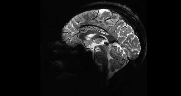 تصاویر مغز انسان در قوی ترین دستگاه MRI