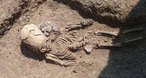 جمجمه‌های غیرعادی بولیوی
