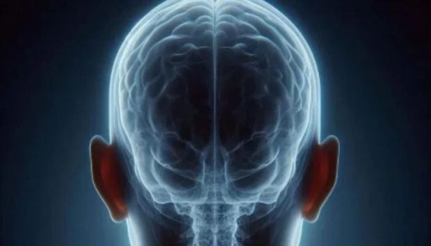 اسکن پزشکی هستهای