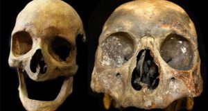تحلیل DNA پاراکاس