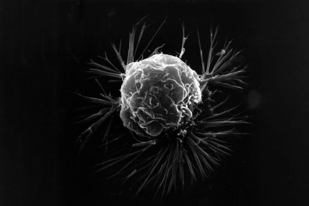 واکسن سرطان