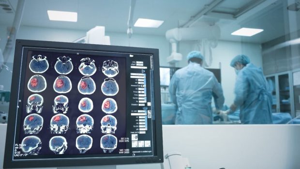 جراحان میکروسکوپی با مغز داخلی