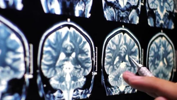 مغز فضانوردان