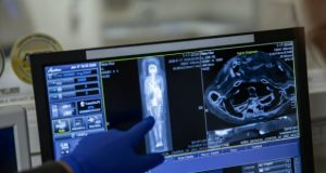 اسکنرهای پیشرفته CT