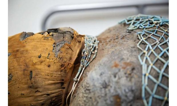 اسکنرهای پیشرفته CT