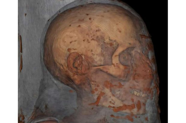 اسکنرهای پیشرفته CT