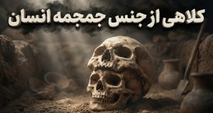 جمجمه کودکان