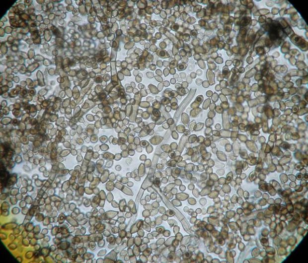 راز عجیب قارچ چرنوبیل