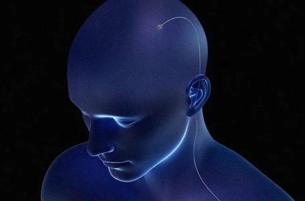 ایمپلنت مغزی چین