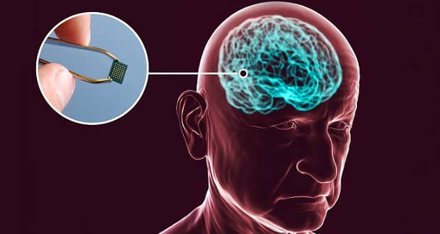 ایمپلنت مغزی چین