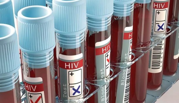 درمان ویروس HIV