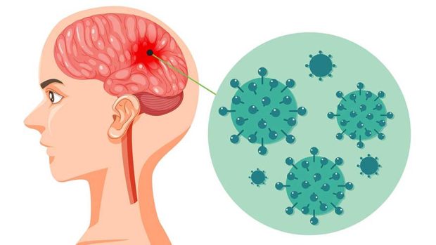 مننژیت (Meningitis)