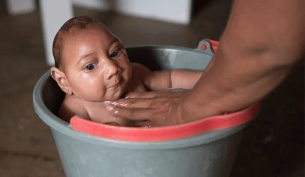 زیکا (Zika Virus)