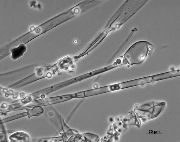 قارچ روده‌ای Mucor racemosus (موکور راسموسوس)
