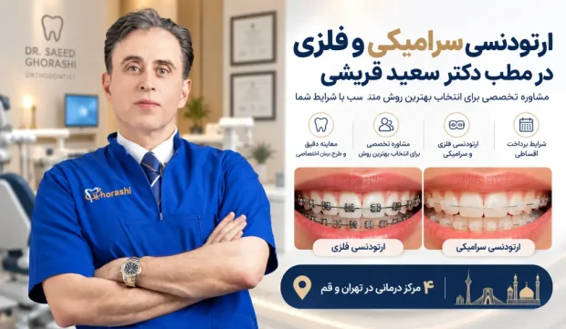 ارتودنسی سرامیکی و فلزی در مطب دکتر سعید قریشی