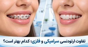 تفاوت ارتودنسی فلزی و سرامیکی